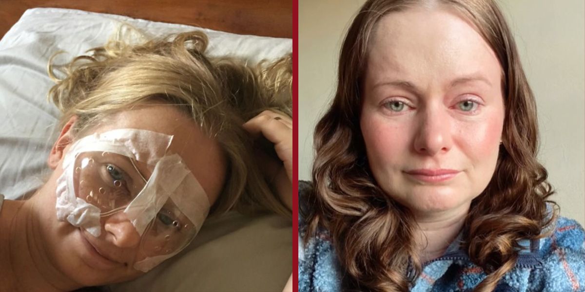 Erin Orchard direkt nach ihrem Eingriff (li.) und heute - geplagt von Schmerzen.