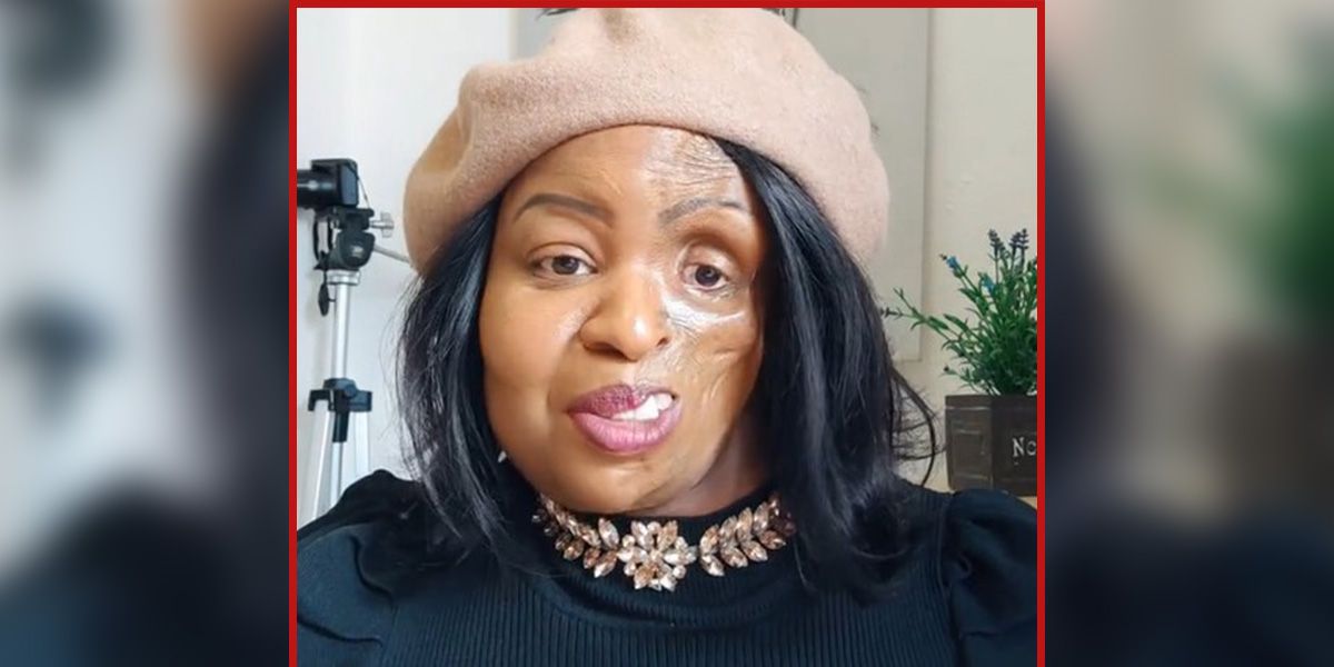 Gillian Kgotla (Bild) hat sich mit ihrem Schicksal arrangiert.