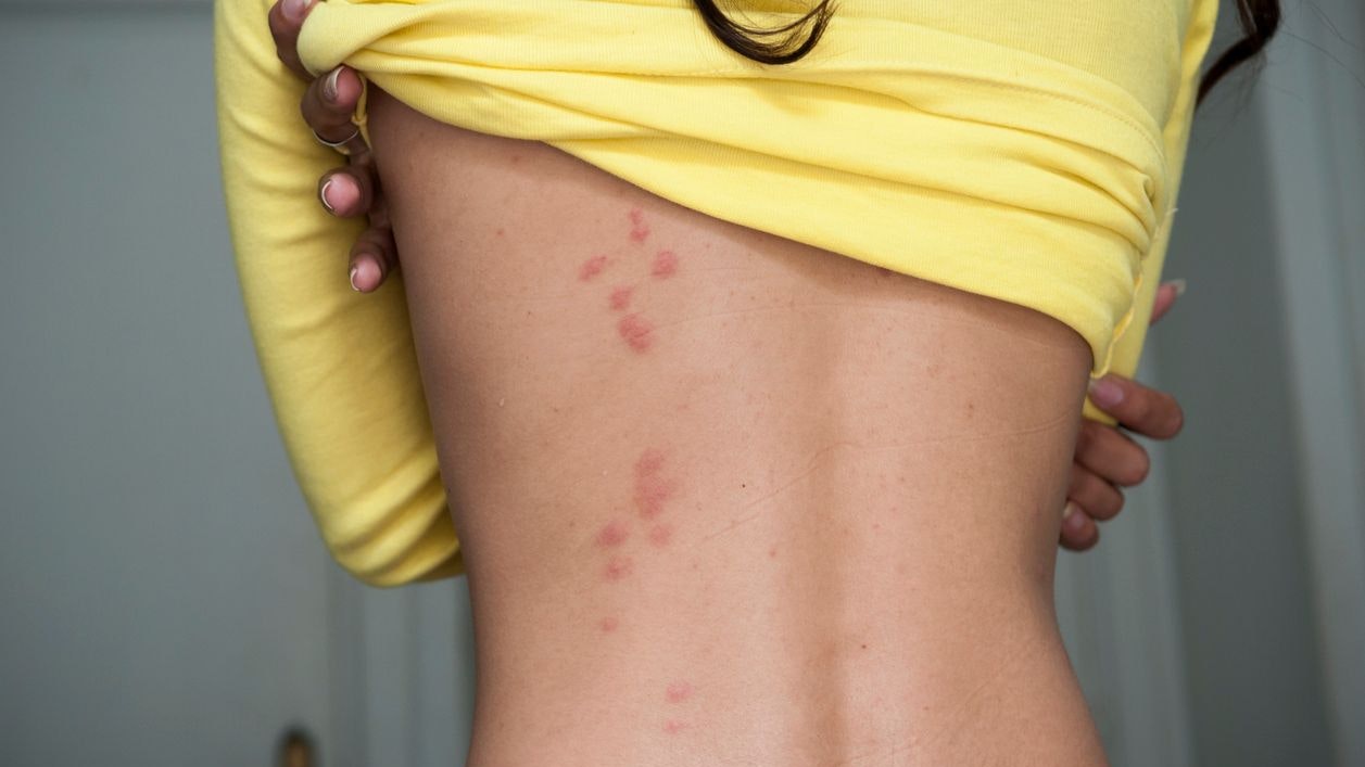 Solche roten Flecken verraten das Vorkommen der Bettwanzen.