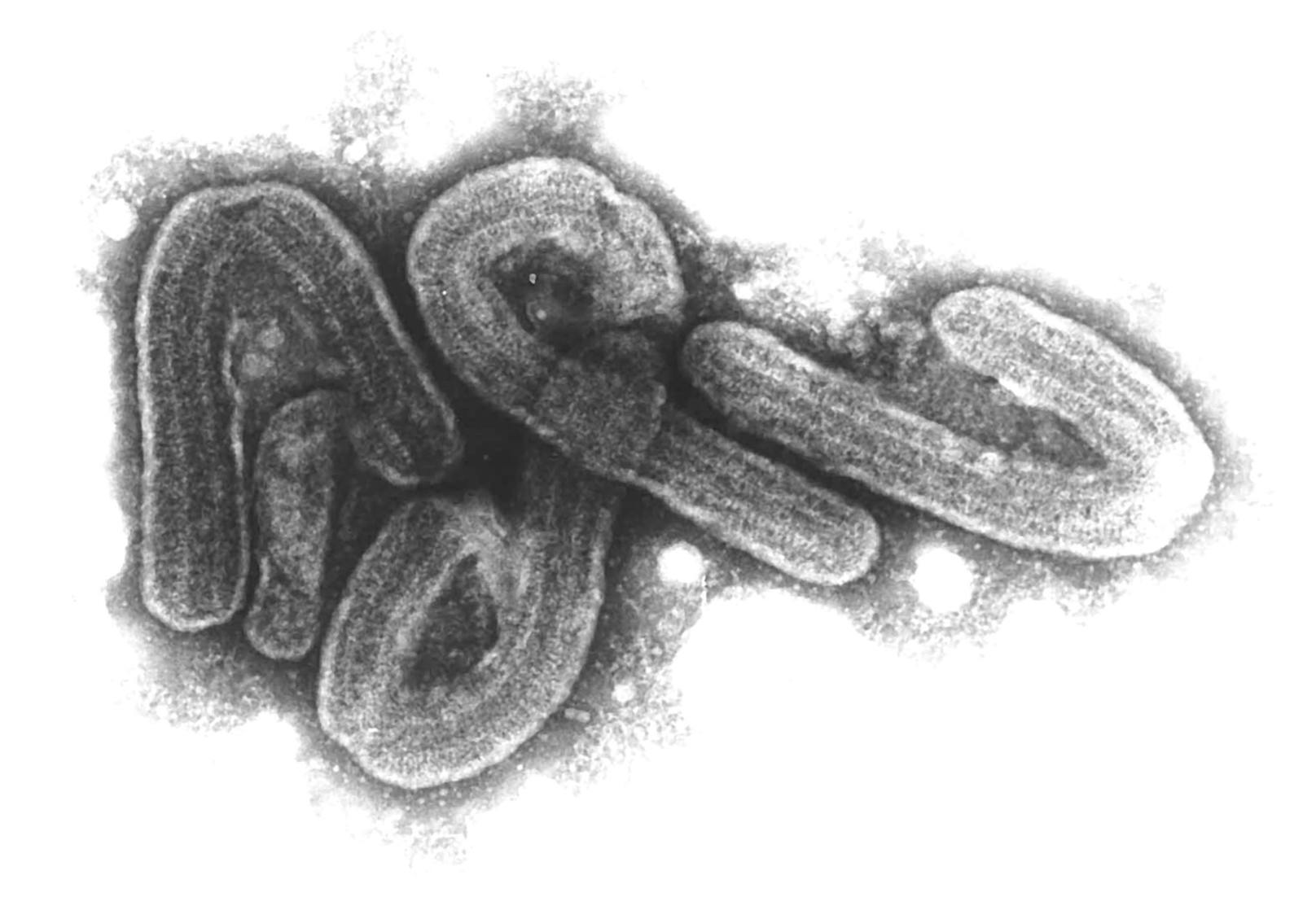 Das Marburg-Virus kann hohes sogenanntes hämorrhagisches Fieber und Symptome wie Muskelschmerzen, Bauchkrämpfe, Durchfall und blutiges Erbrechen auslösen. Nach Angaben der Weltgesundheitsorganisation (WHO) starben bei den bisherigen Ausbrüchen 24 bis 88 Prozent der Erkrankten.