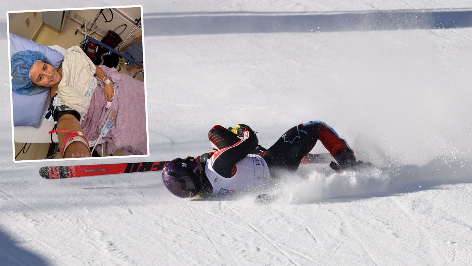 Sechste Operation! Langer Leidensweg von Ski-Ass