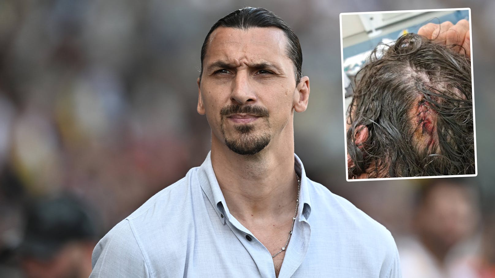 "Teil des Spiels!" Ibrahimovic zeigt blutende Kopfwunde