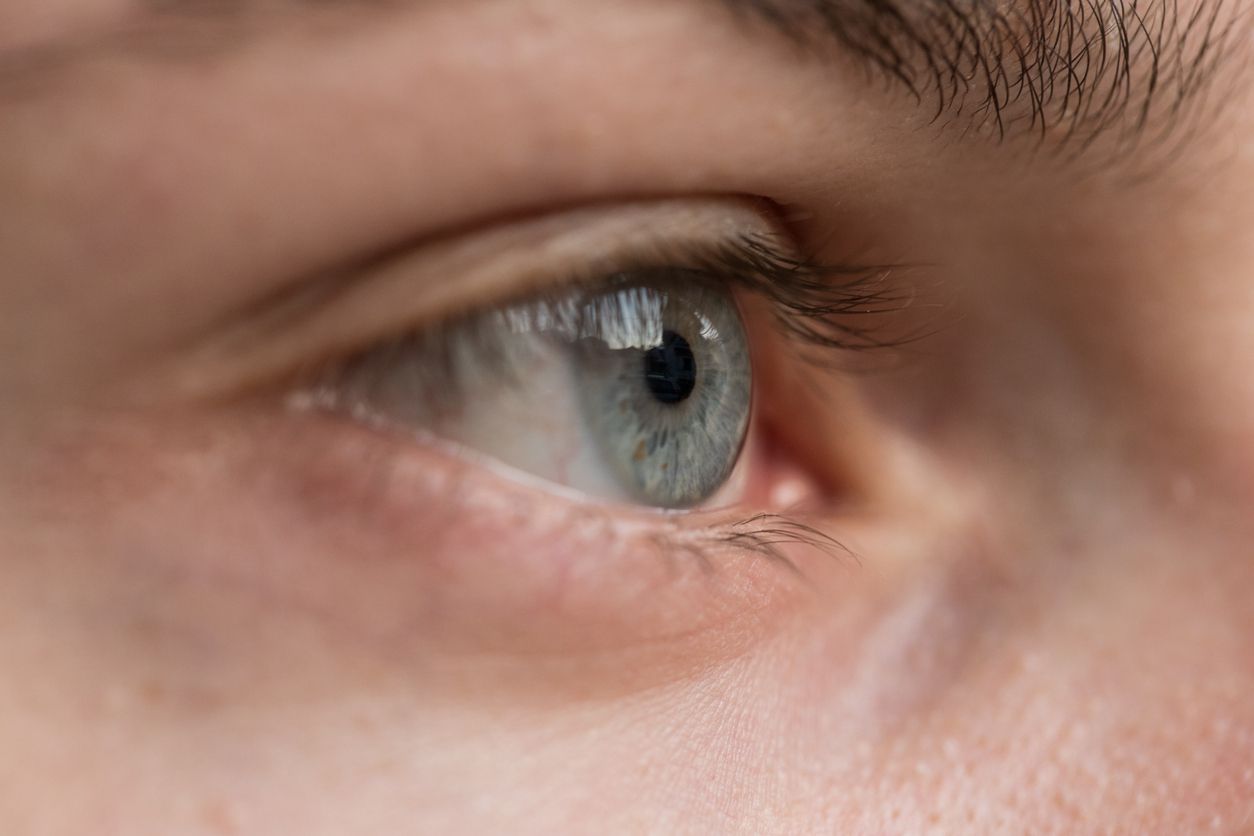 Augenzucken: Besonders oft betroffen sind Menschen, die viel Stress haben.