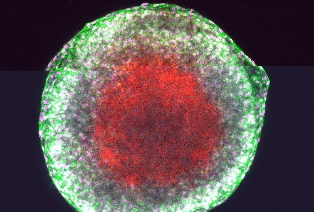 Im entscheidenden Moment wird die Eizelle (rot) aus dem Follikel katapultiert.