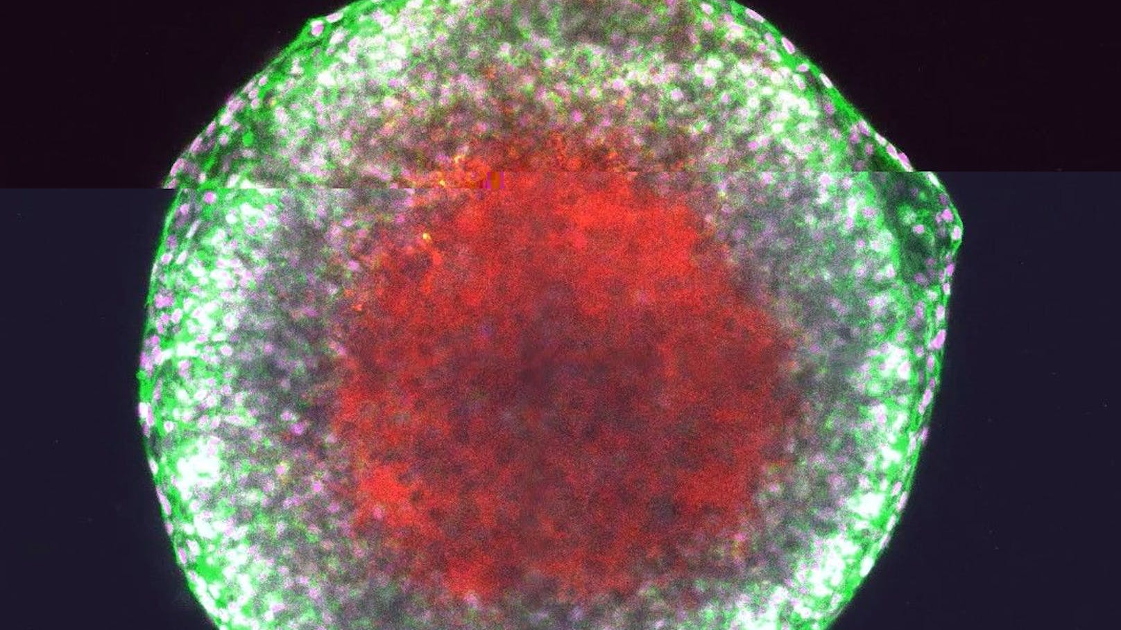 Erstmals gefilmt: Video zeigt wie ein Eisprung passiert