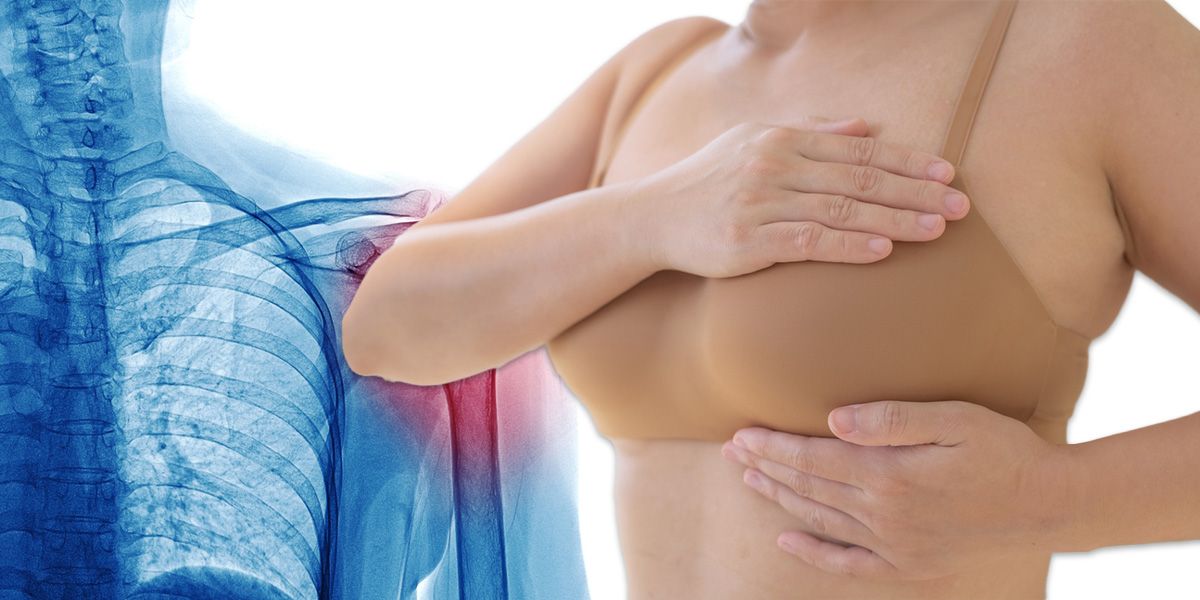 Jede Frau sollte einmal jährlich zur Brustkrebsvorsorge.