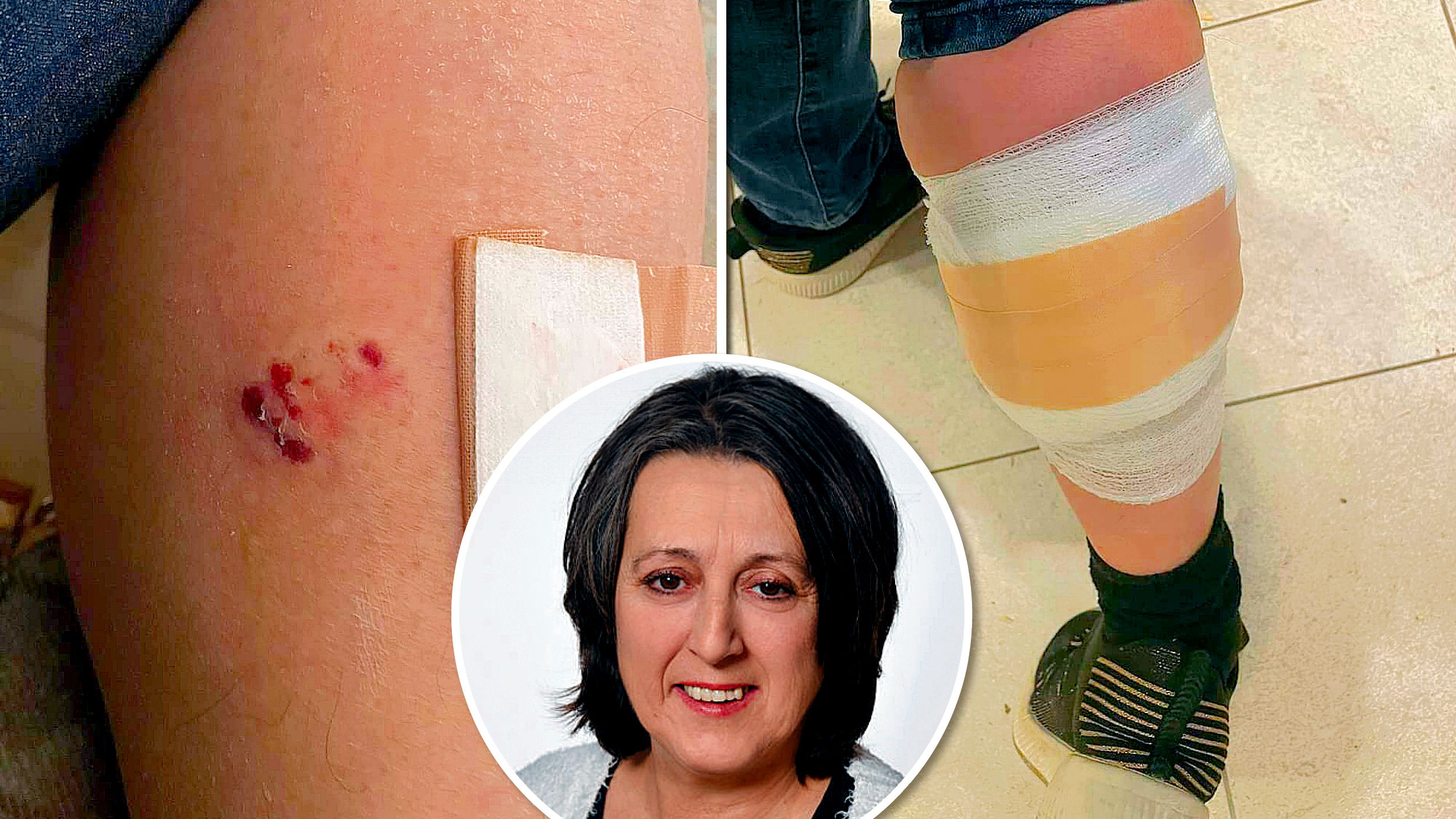 Tatiana Fuchs (57) wurde von Hund attackiert