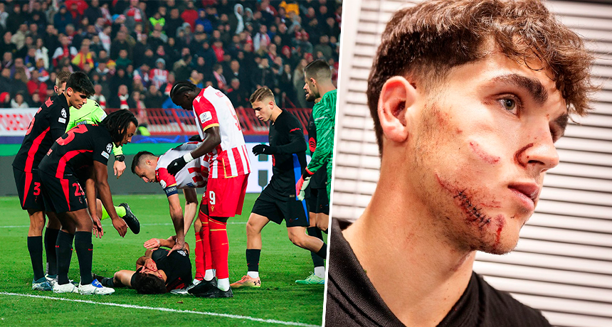 Pau Cubarsi bekam gegen Roter Stern Belgrad einen Schuh ab, musste noch vor Ort genäht werden.