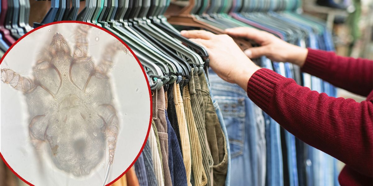 In Secondhand-Mode können sich Milben verstecken, die Hautkrankheit Krätze verursachen.
