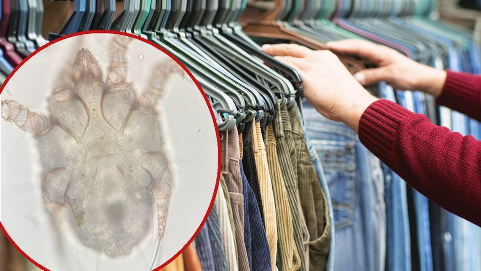 Diese Parasiten können in Secondhand-Kleidung stecken