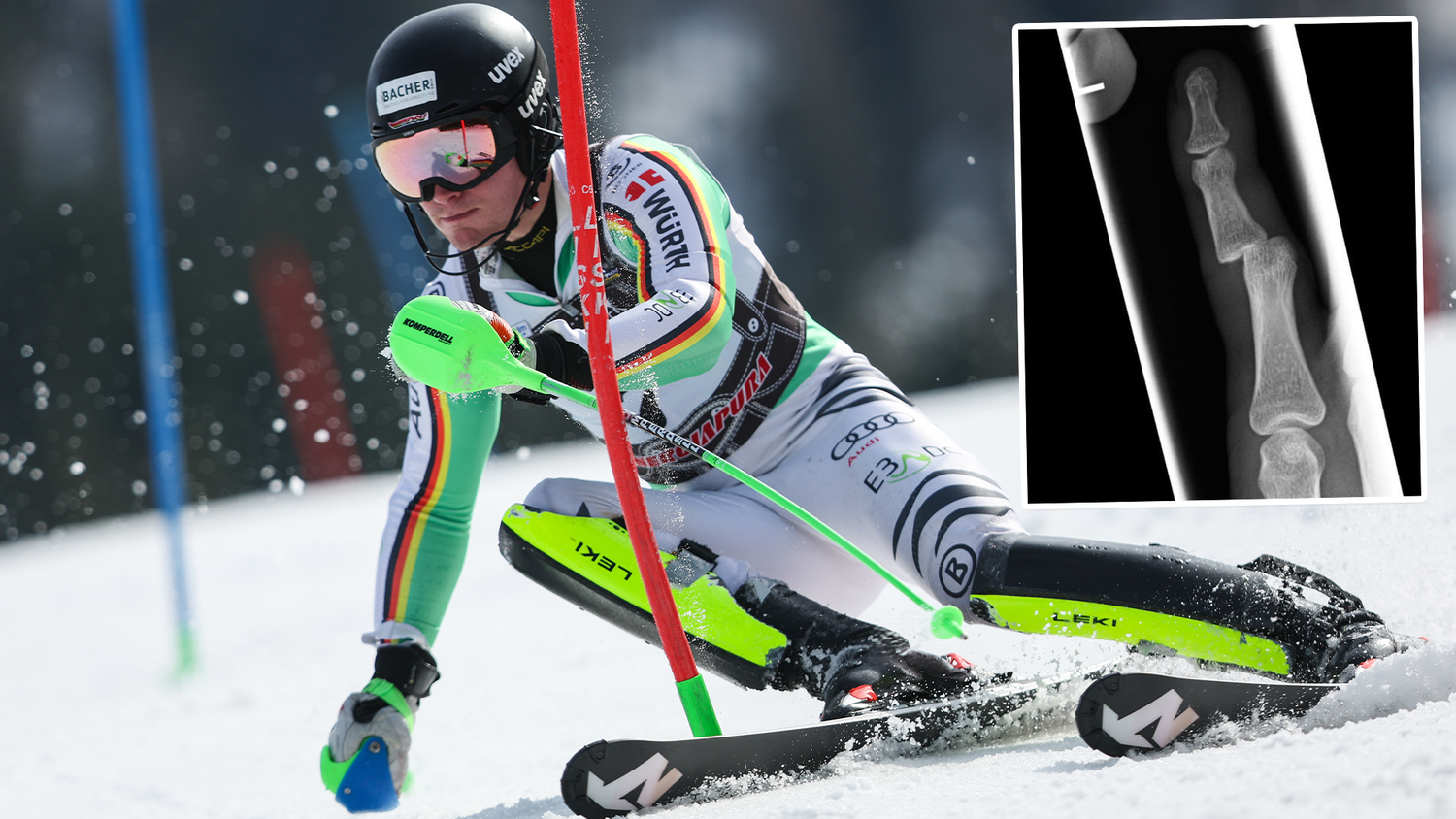 Linus Witte musste einen Rückschlag hinnehmen.