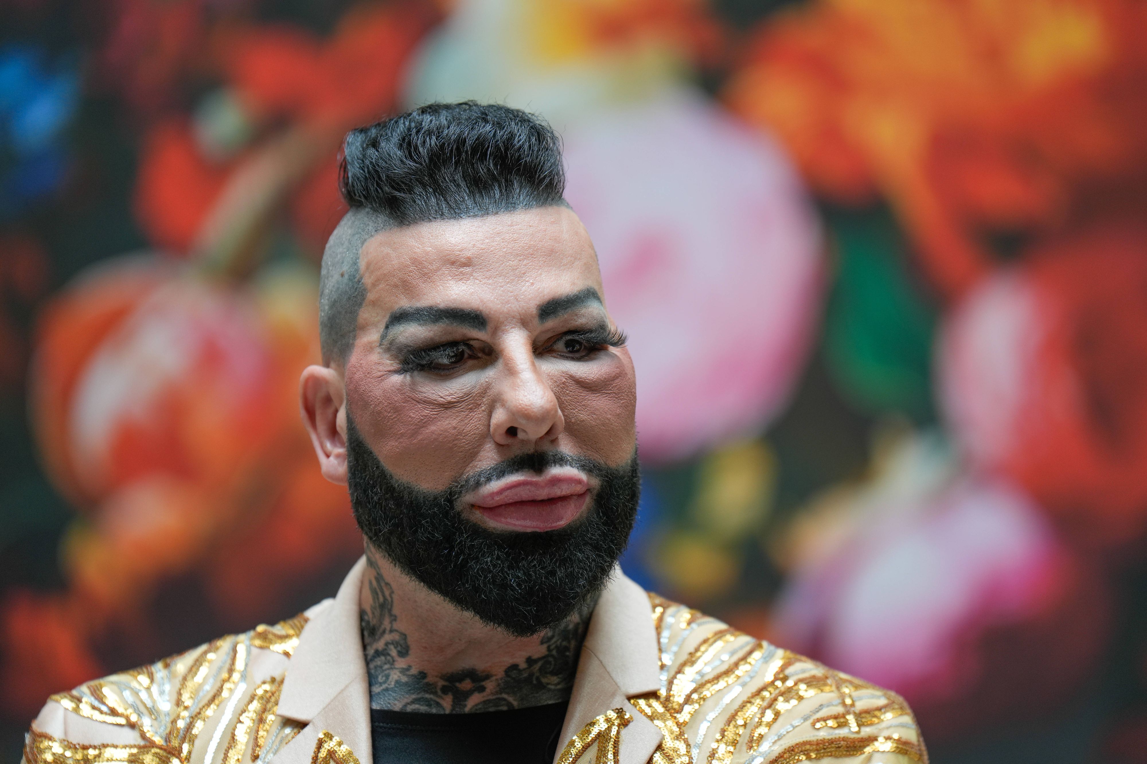 Für Harald Glööckler sind diese OP-Ausgaben jedoch alles andere als Verschwendung.