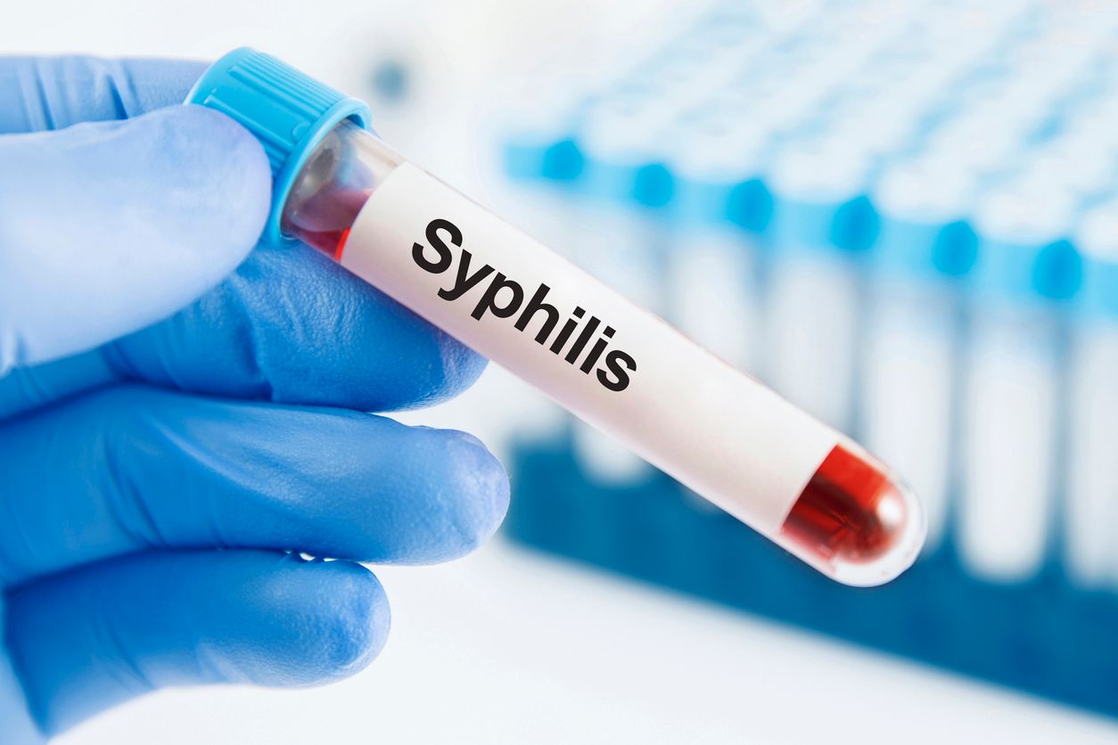 Geschlechtskrankheiten steigen europaweit an.