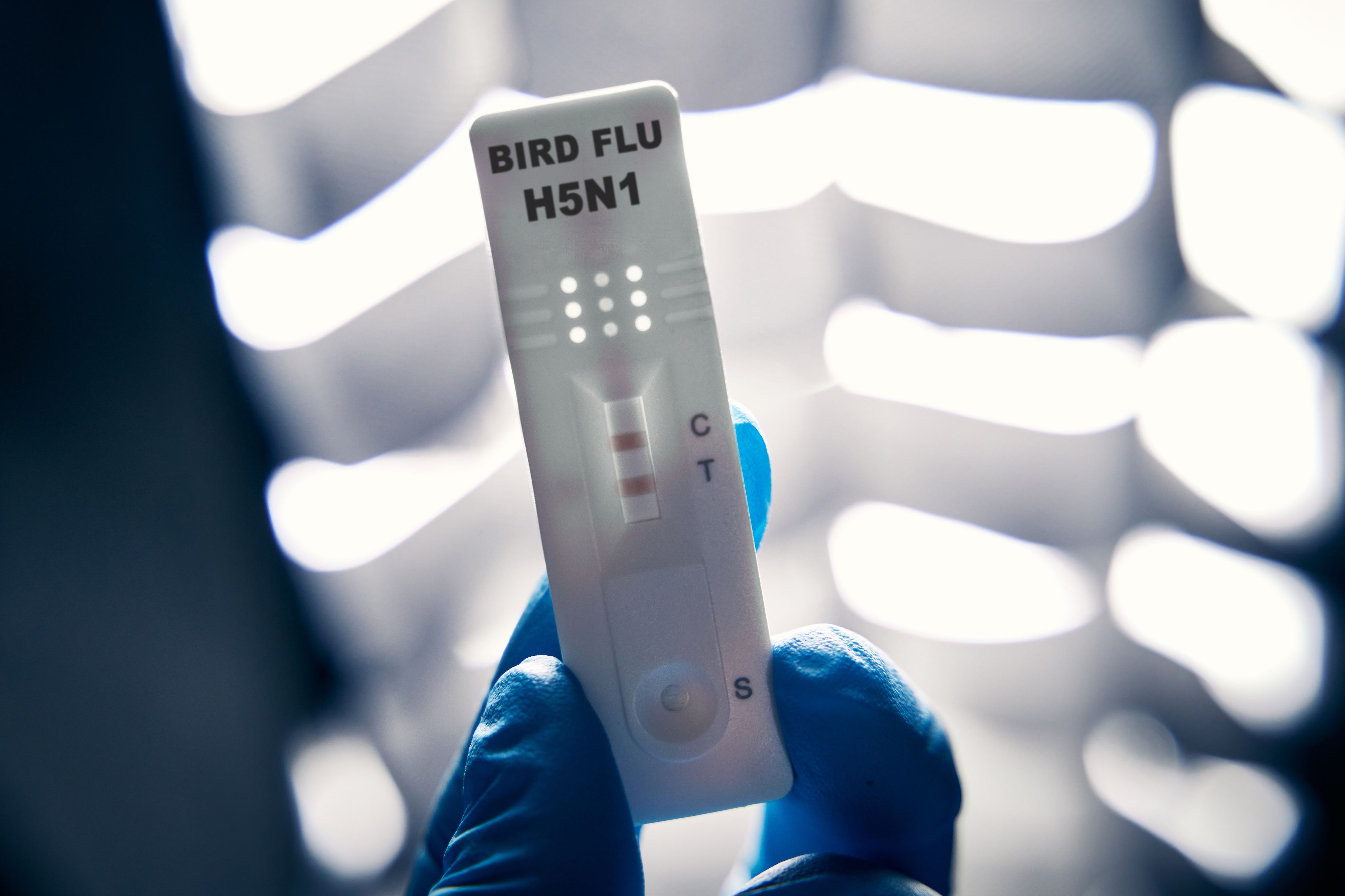 Wo sich das Kind angesteckt hat, ist derzeit noch unklar.