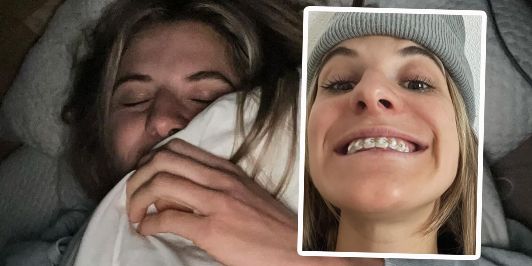 Alina Meier zeigt ihre Zahnschiene