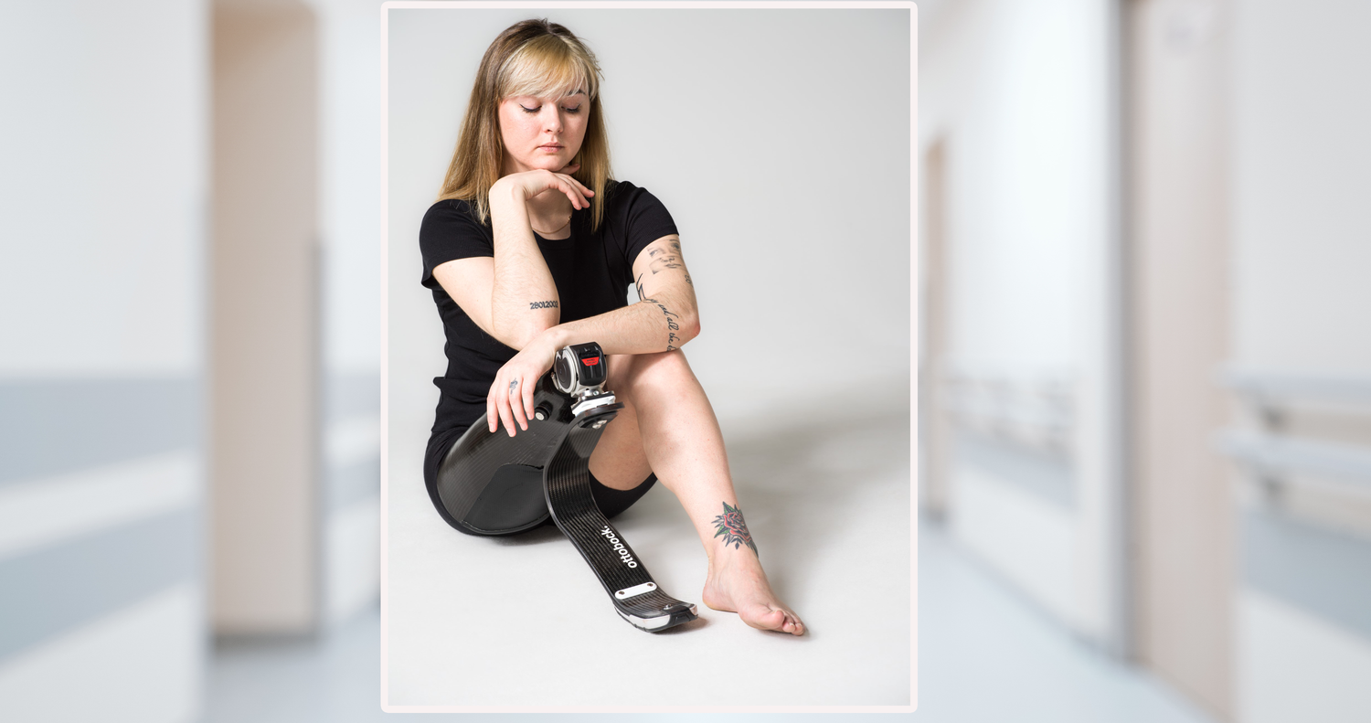 Johanna U. hat nach einem Autounfall den rechten Unterschenkel verloren. Im Buch "Reset" zeigt sie, dass das kein Grund ist, sich zu verstecken.