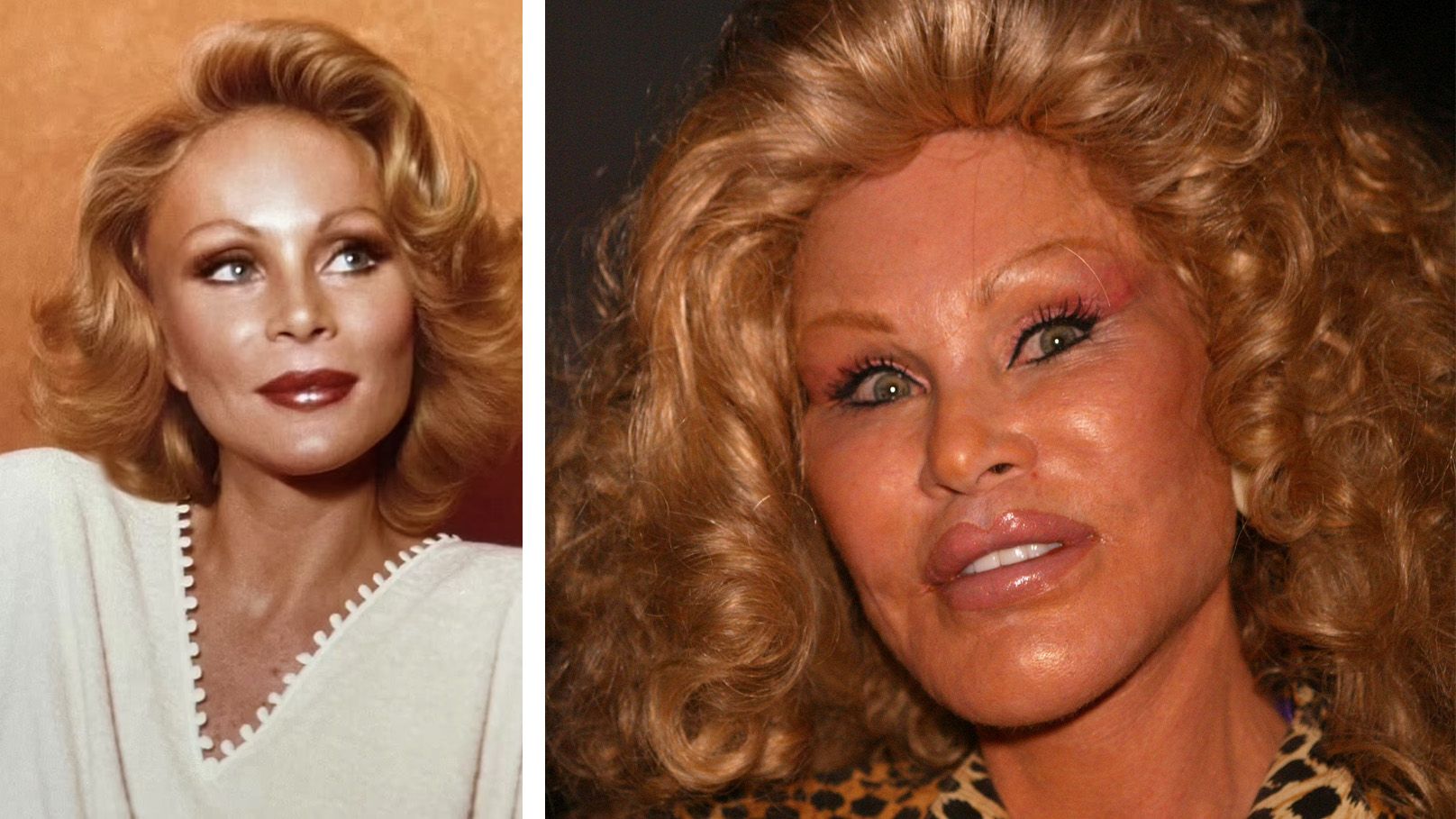 Jocelyne Wildenstein erklärt, sie hatte nie einen Beauty-Eingriff.