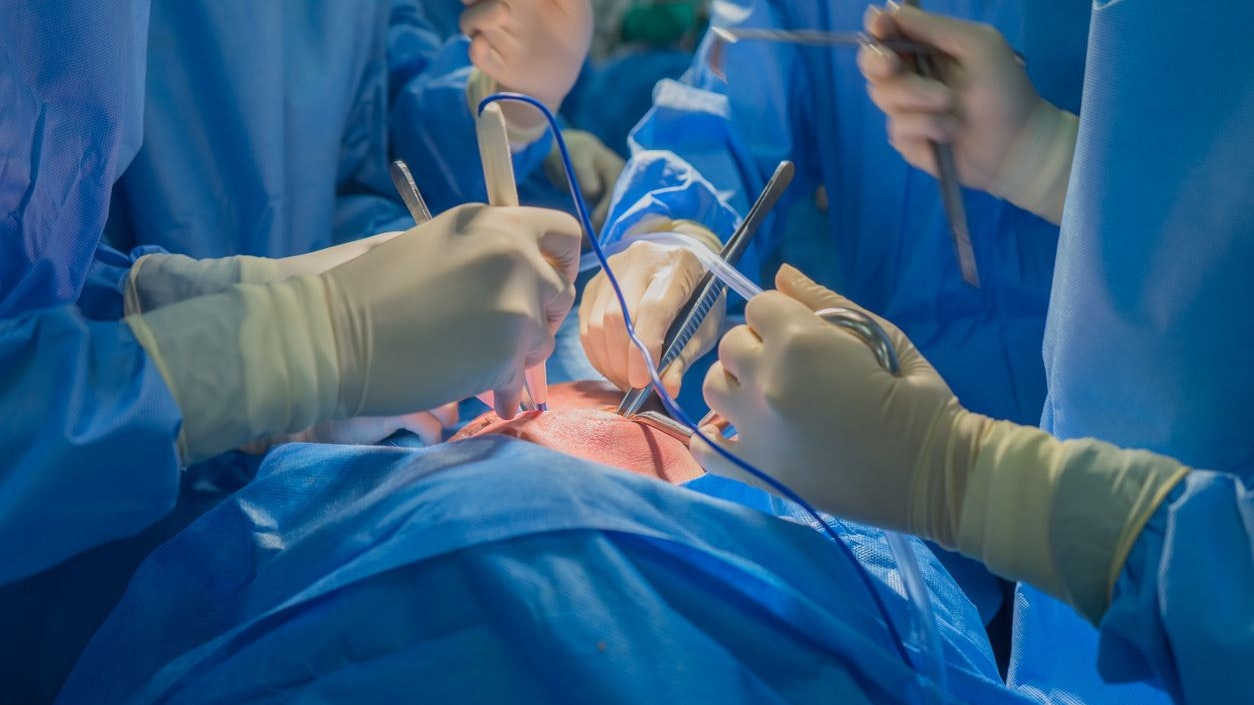Doctors team wear blue coat perform heart surgery at the operating room in the hospital.