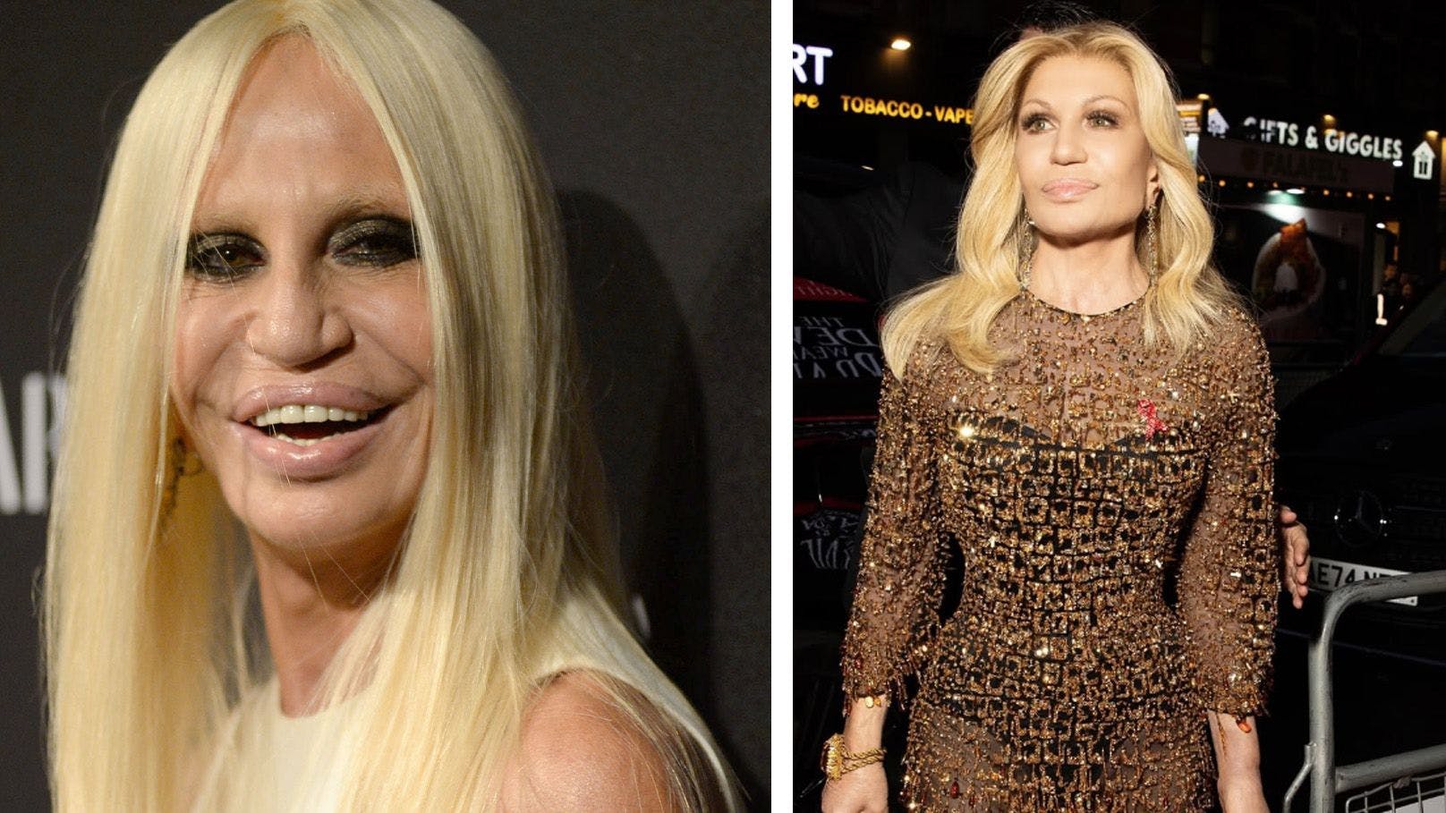 Neues Gesicht! Wirbel um Donatella Versaces Aussehen