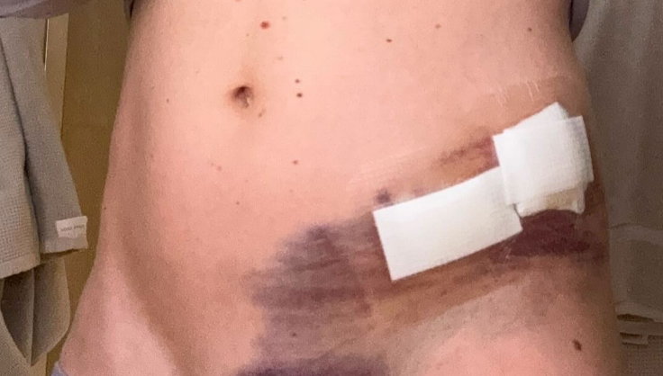 Shiffrin zeigt ihre Verletzung