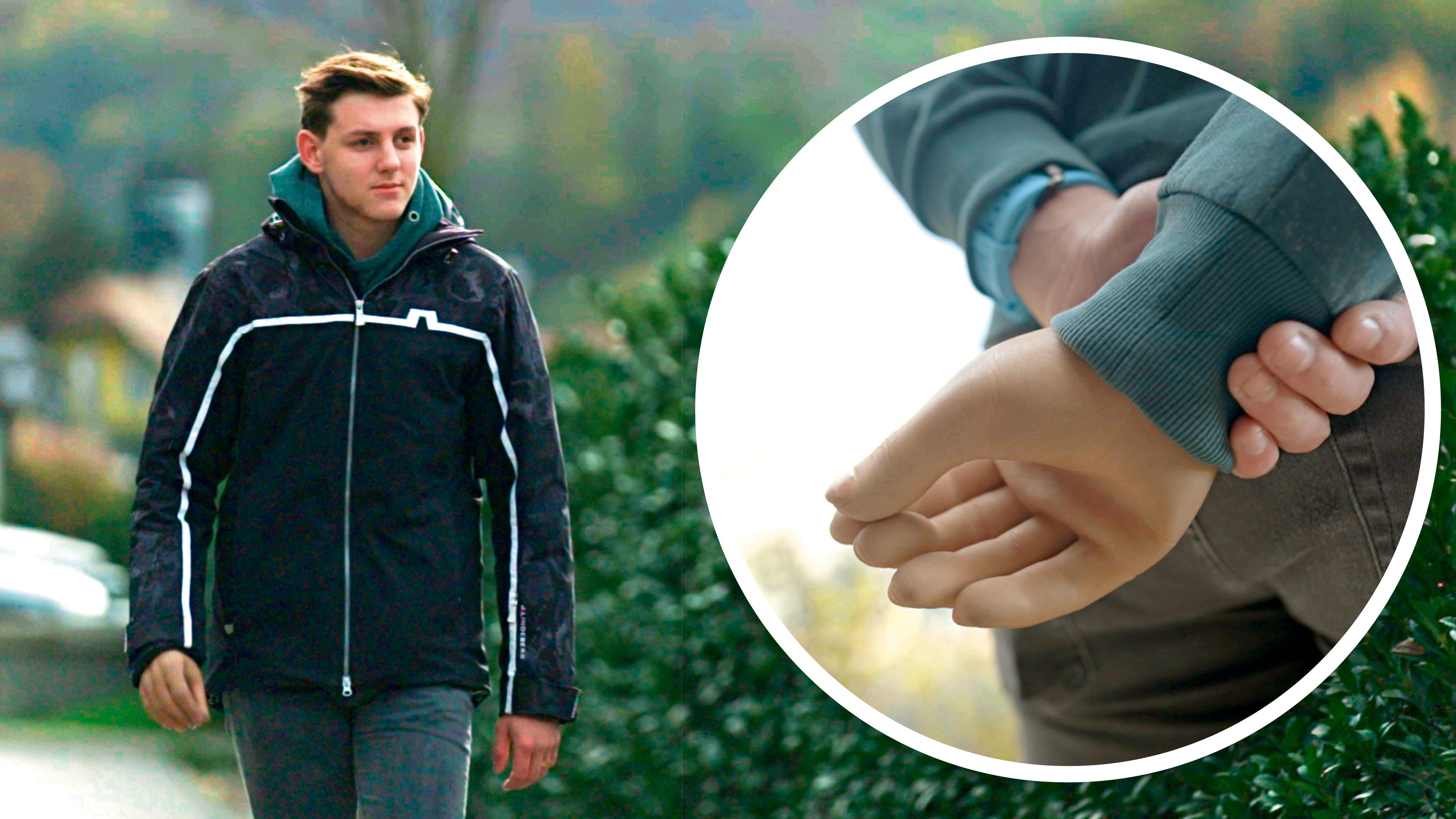 Tobias erzählt über seinen schweren Böllerunfall.