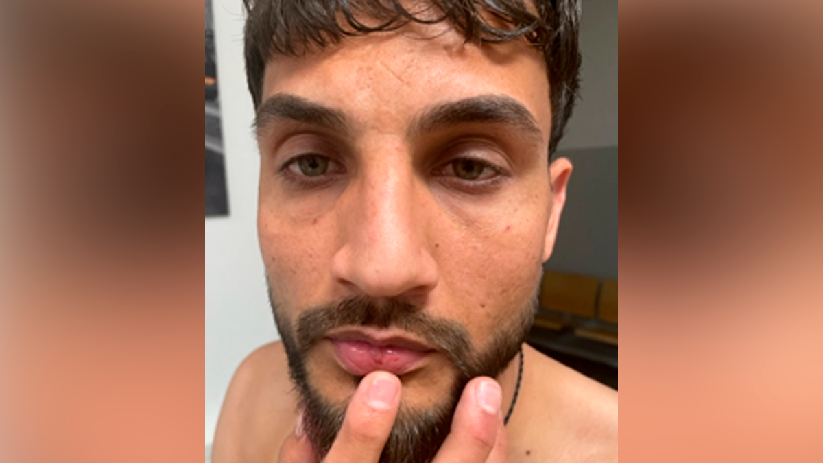 Fahndung! Die Wiener Polizei sucht diesen Mann nach einem Messerstich auf der Neulerchenfelder Straße am 10. Dezember 2024.