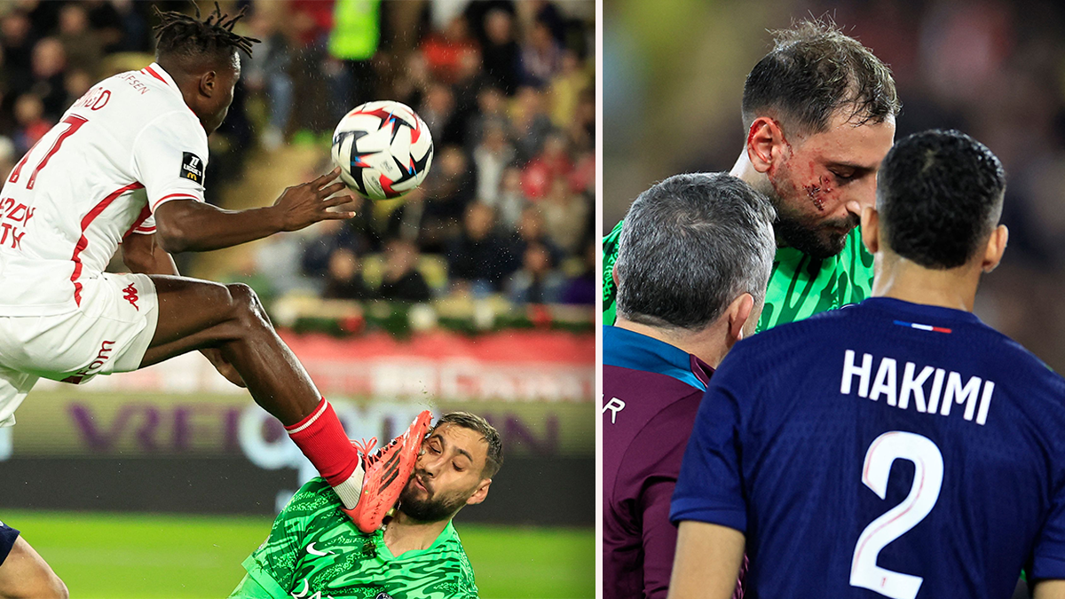 Gianluigi Donnarumma musste nach einem brutalen Tritt ausgewechselt werden.