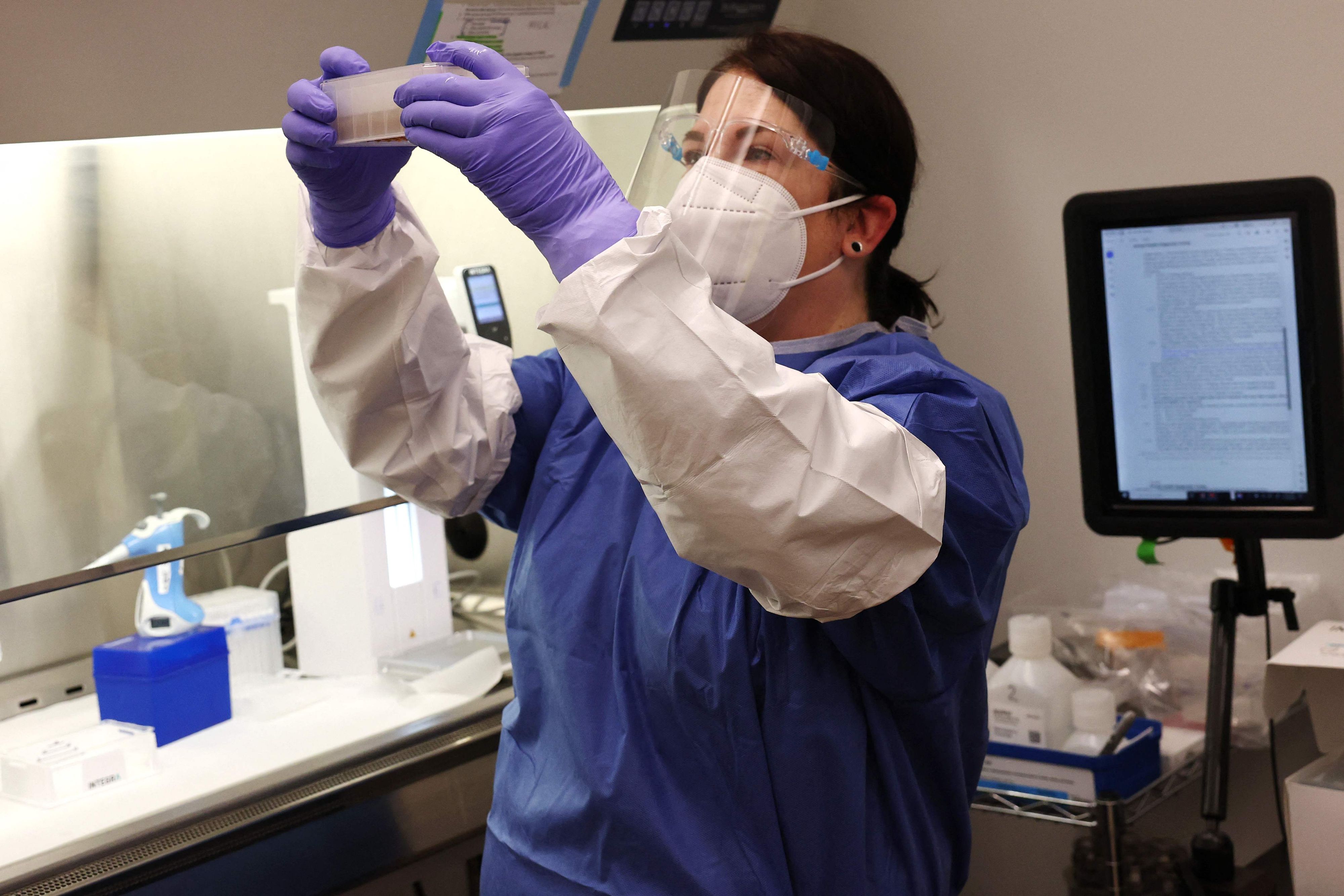 Eine Labormitarbeiterin untersucht Milchproben auf eine H5N1-Infektion. New York, 10. Dezember 2024.