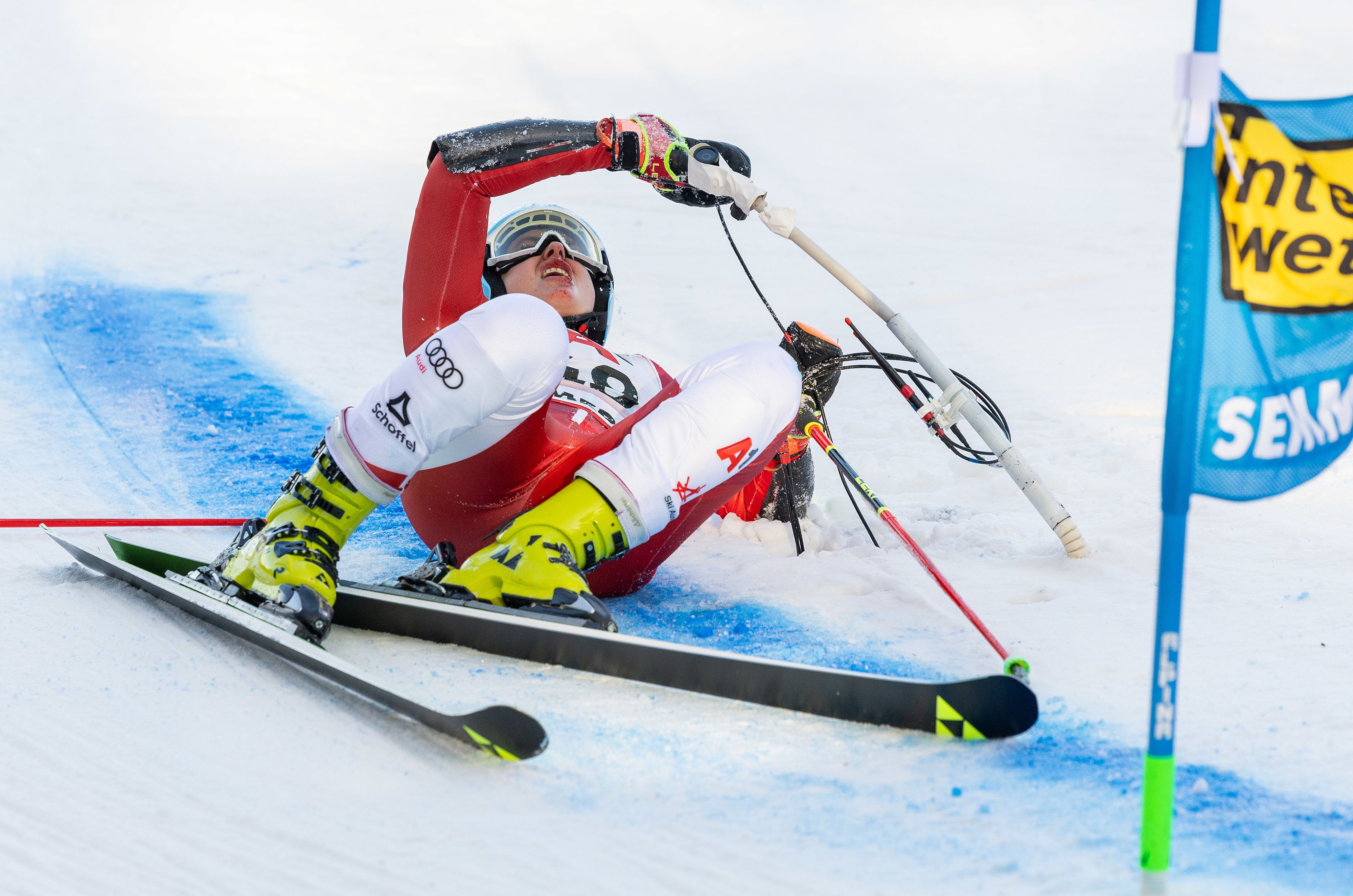 Katharina Huber erlitt bei ihrem Sturz Abschürfungen im Gesicht.