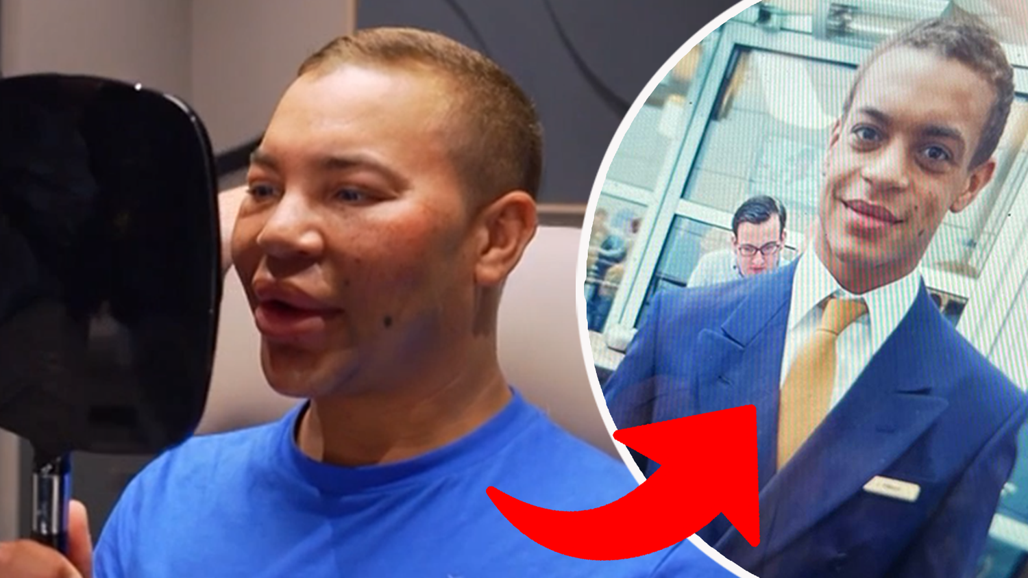 Ein altes Foto von Julien hat den Schönheitschirurgen Dr. Nick schockiert. Er will dorthin zurück. Mit Erfolg, wie die späteren Aufnahmen zeigen.