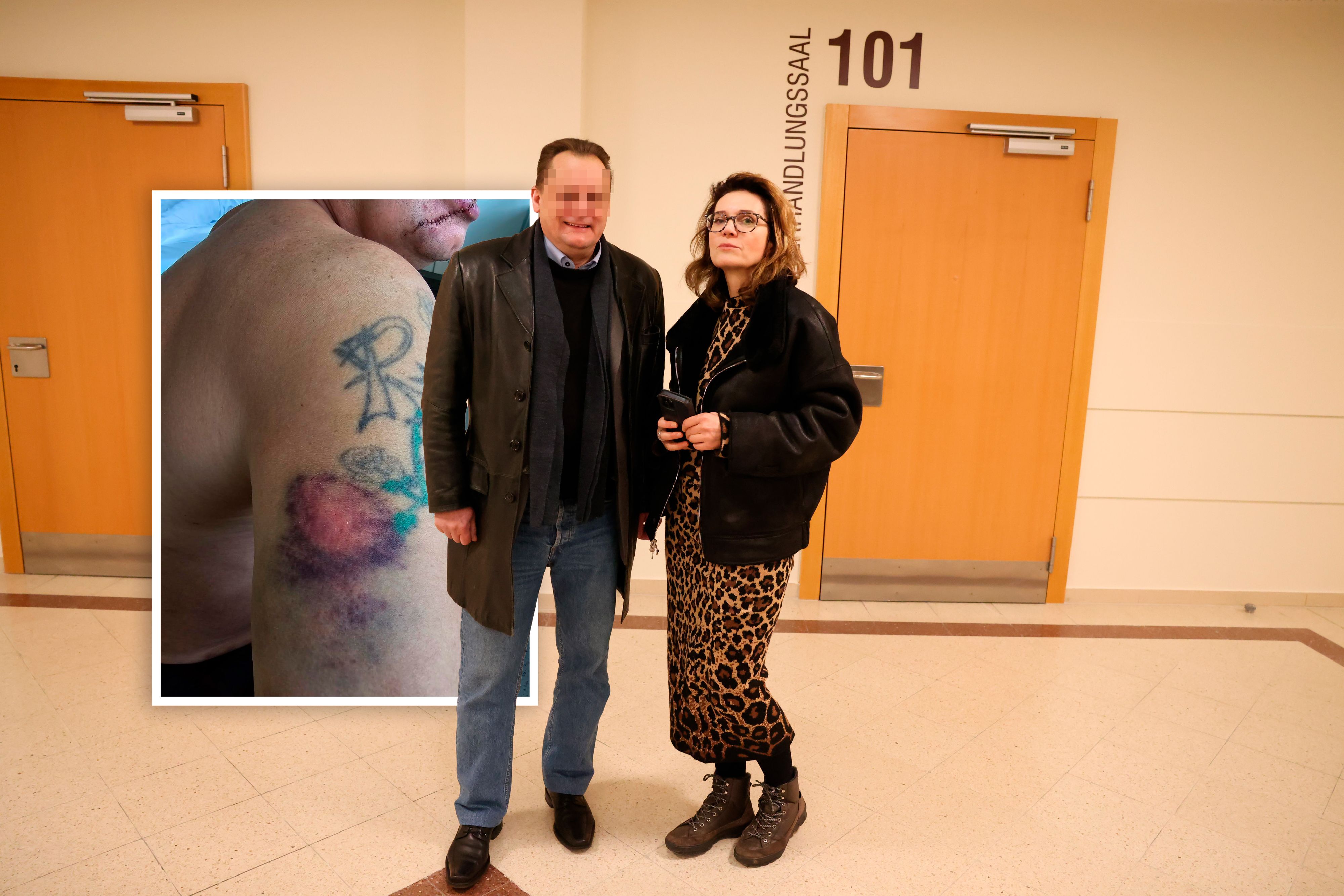 Das Biss- und Messeropfer René E. (53) musste vor Gericht – schließlich wurde er im Zweifel freigesprochen.