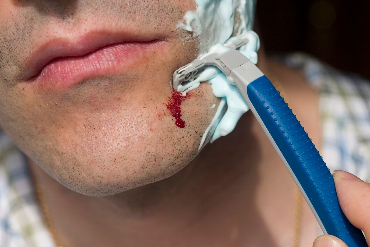 Anstatt seine Schnittwunden als Erfahrung abzutun, beschloss Nick Silverthon , den Hersteller des Rasierers zu verklagen. (Symbolbild).