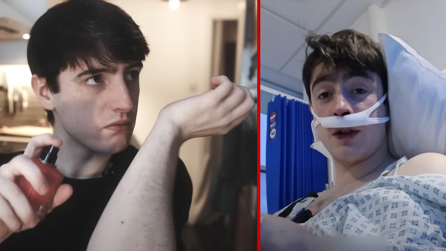 James Odgers unterzog sich letztes Jahr dem Eingriff an seiner Nase (re.)