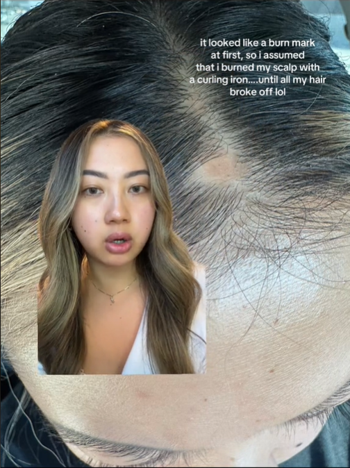 Der Beauty-Influencerin gingen nach Besuchen im Fitnessstudio die Haare aus.