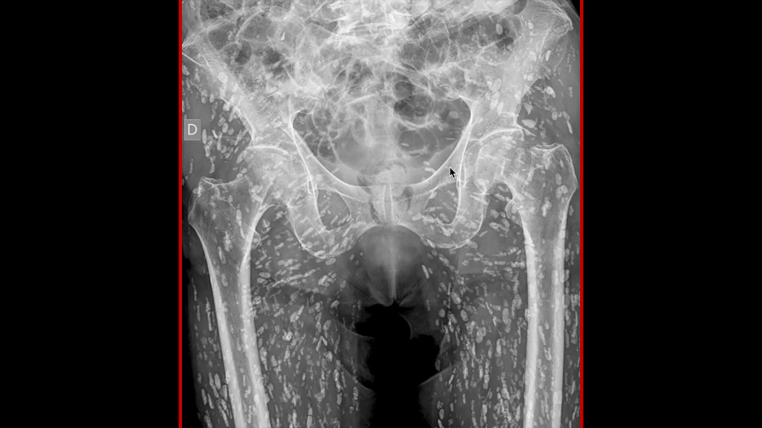 Das Röntgenbild des Patienten (oben).