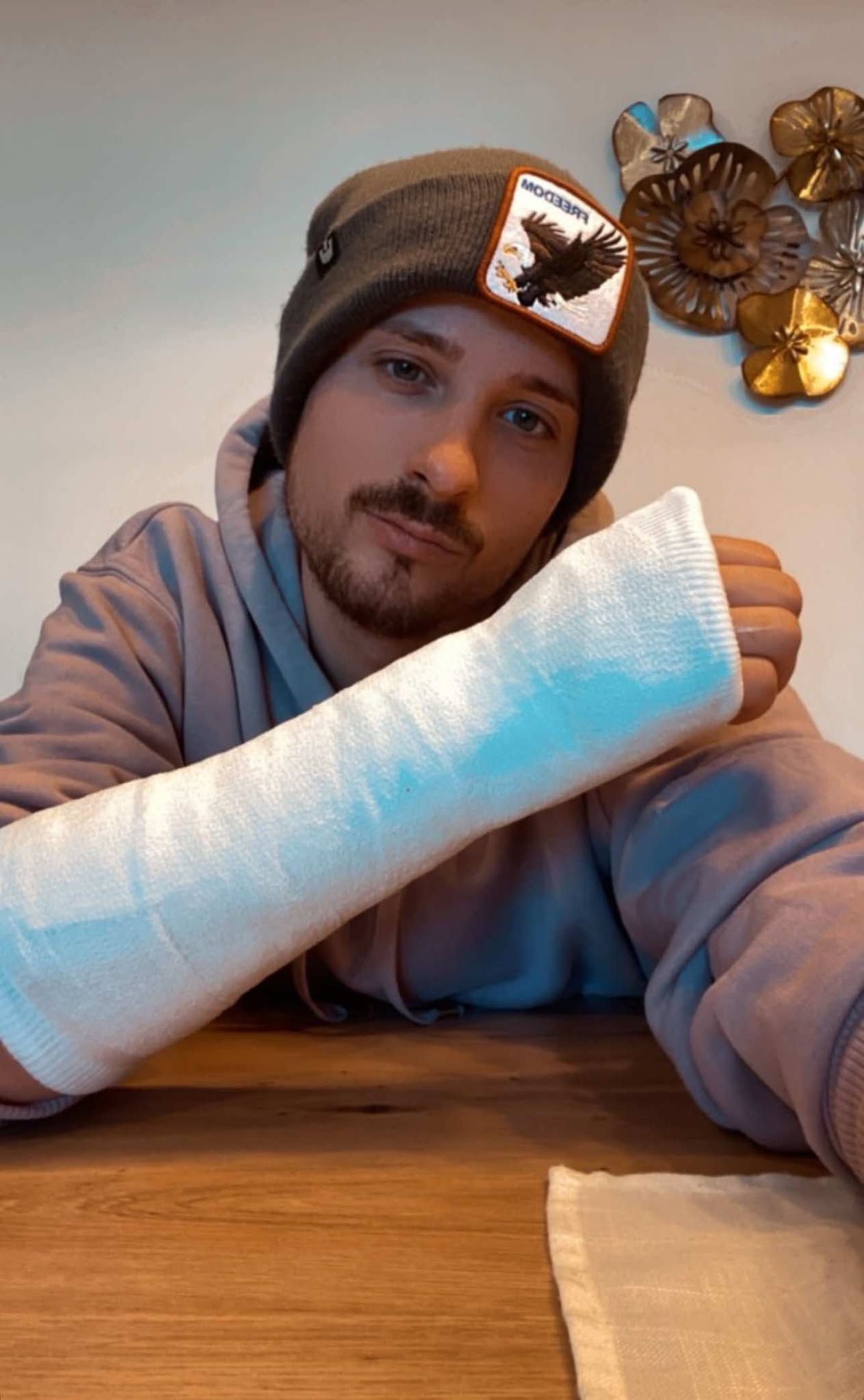 Johannes Höfinger muss nun fünf Wochen Gips tragen