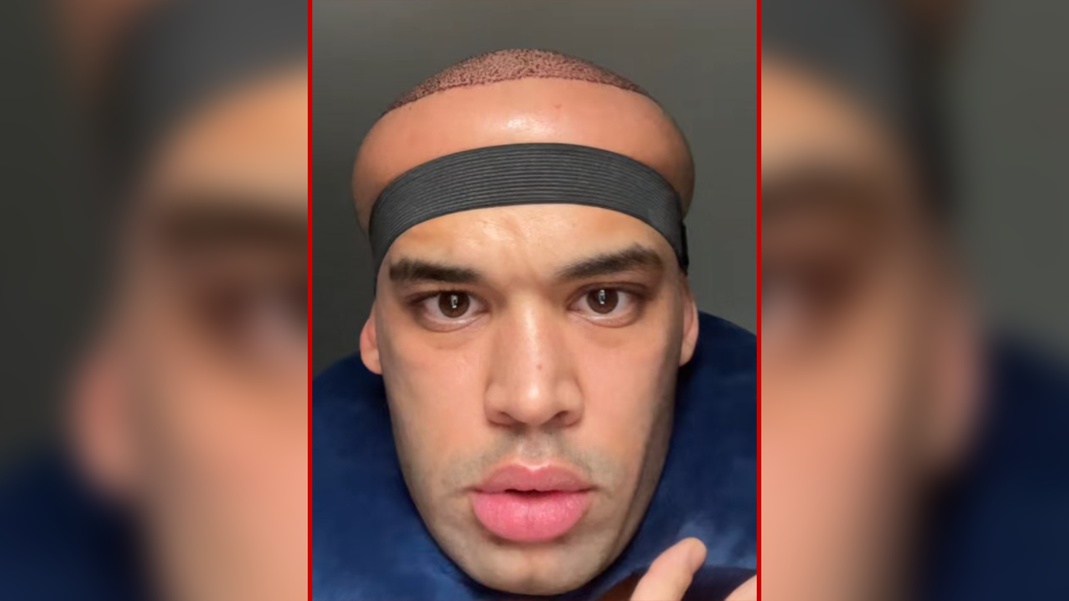 Kanah Flex (Bild) begleitet seine Genesung auf TikTok.