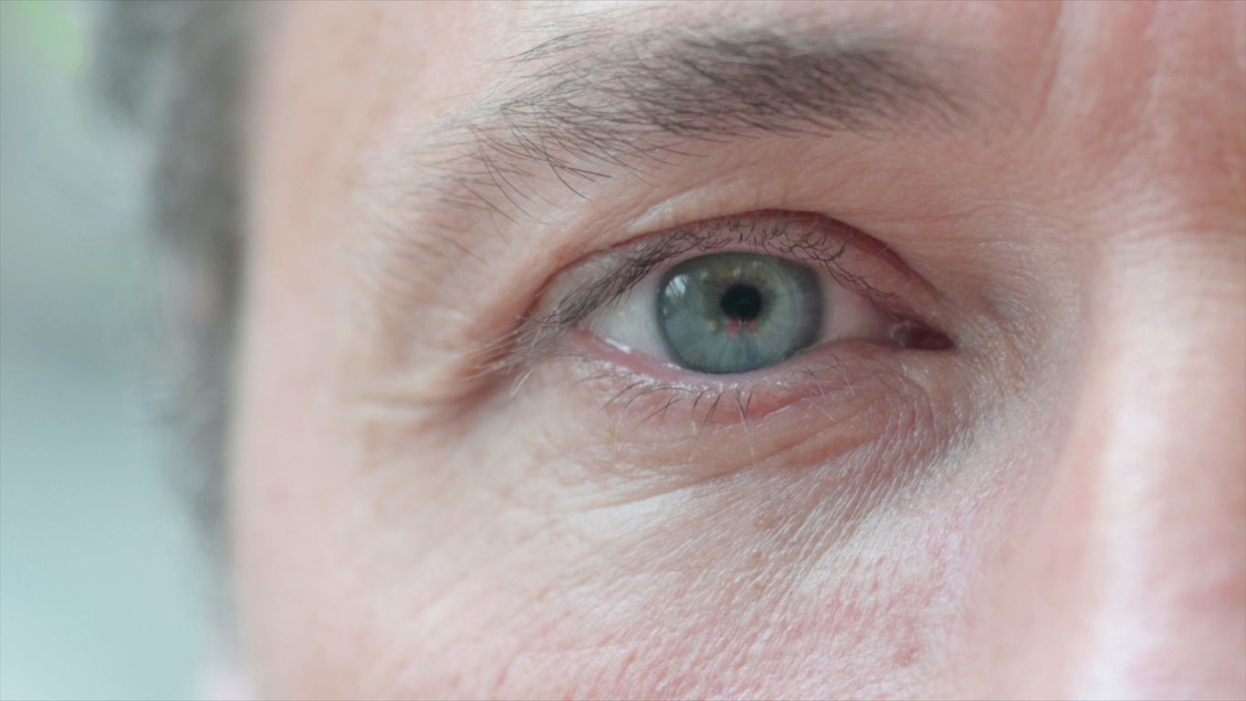 Das Glaukom bleibt lange ohne Symptome. Bereits eingetretene Schäden sind dann jedoch unumkehrbar und nicht heilbar.