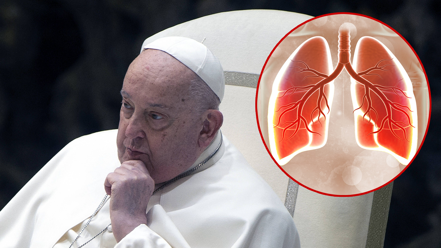 Der 88-jährige Papst Franziskus (Bild) befindet sich weiter im Spital.
