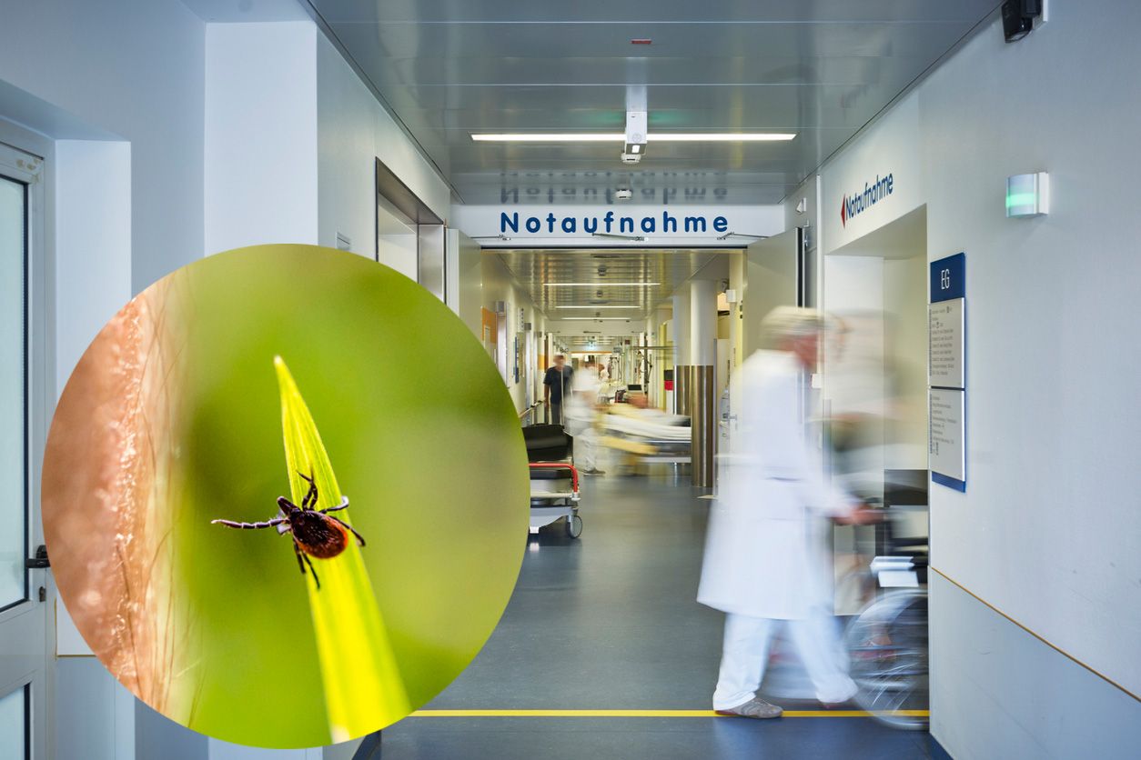 Ein 35-Jähriger war nach einem Zeckenbiss zu beunruhigt, dass er mit dem Tier in die Notaufnahme kam. (Symbolbild)
