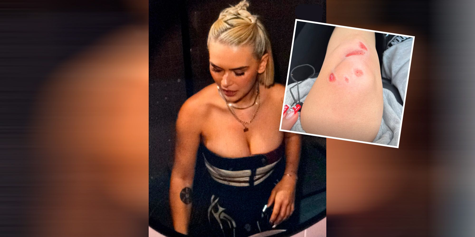 Mathea hat sich am Knie verletzt.