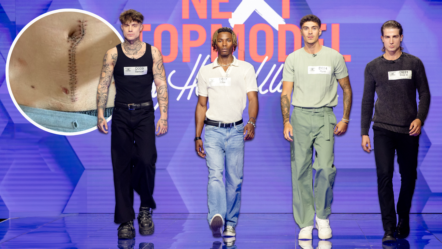 Auf Instagram zeigt GNTM-Kandidat Samuel die frisch genähte Wunde nach dem Messerangriff.