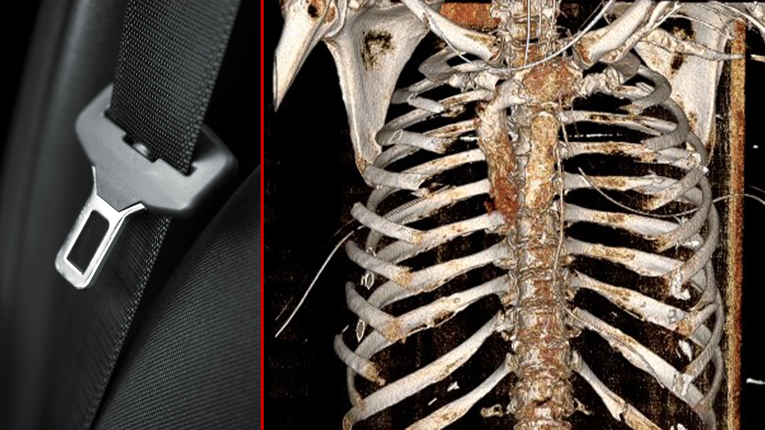 Sicherheitsgurte retten Leben.