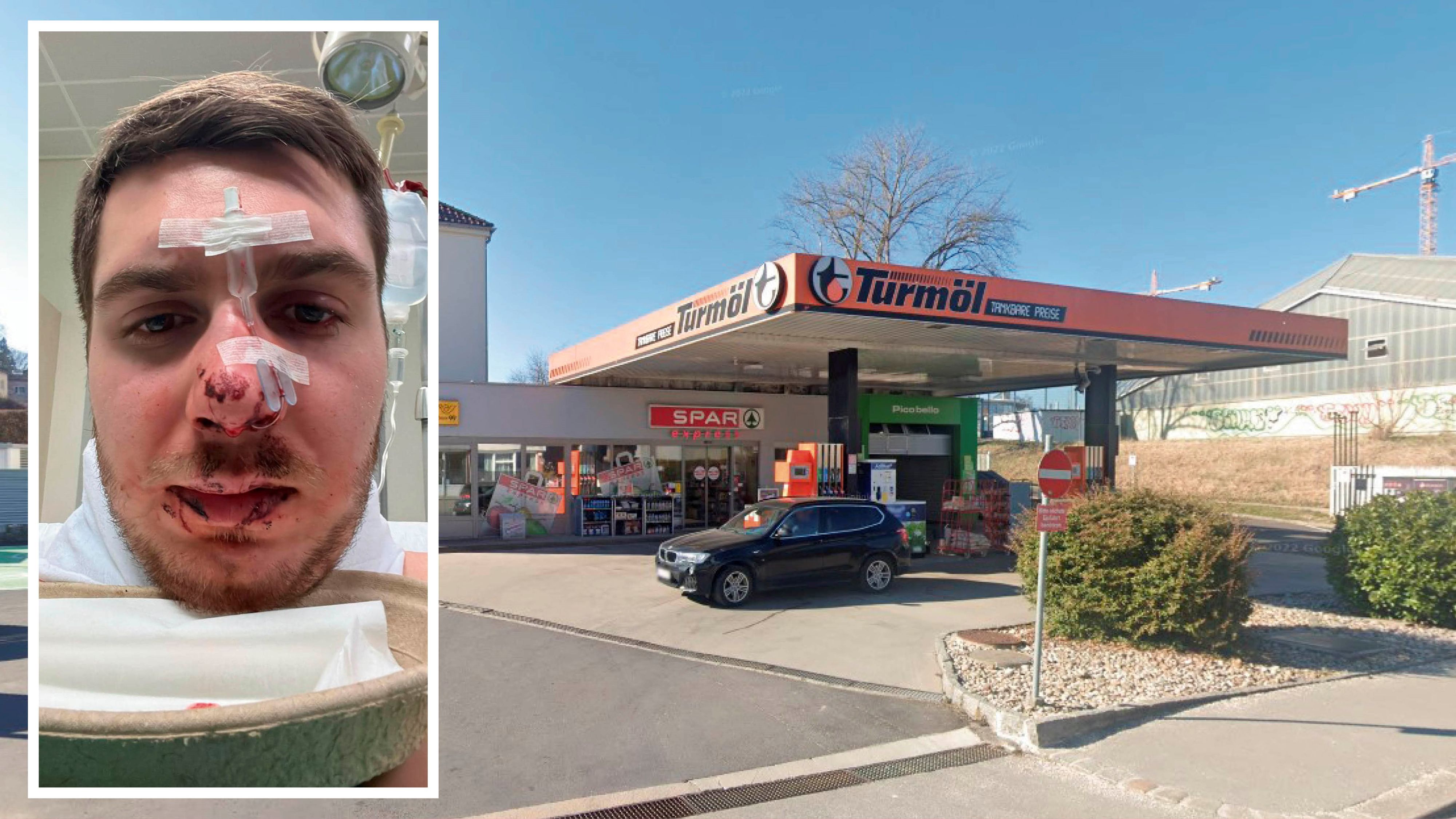 Marco R. (23) wurde vor dem Match brutal bei der Tankstelle am Linzer Froschberg zusammengeschlagen.