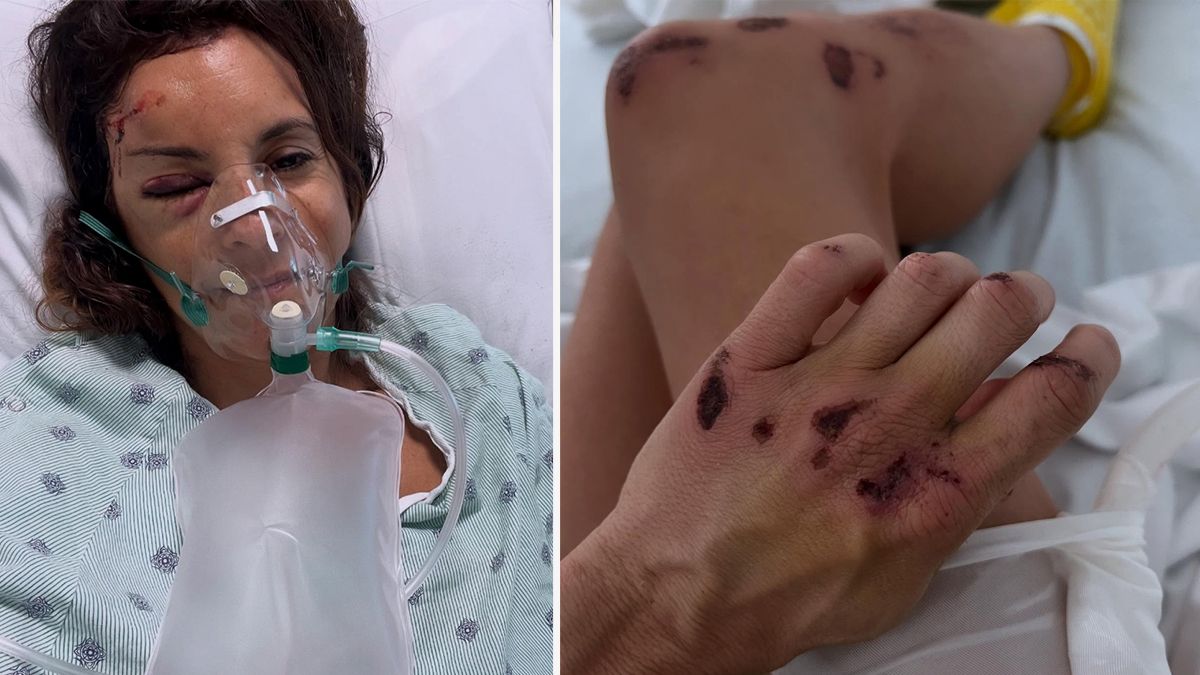 Marion Grosjean musste schwer verletzt ins Spital gebracht werden. 