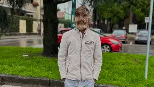 In seiner Kindheit wurde er oft angestarrt und von anderen Kindern gefürchtet, doch mit der Zeit akzeptierten sie ihn.