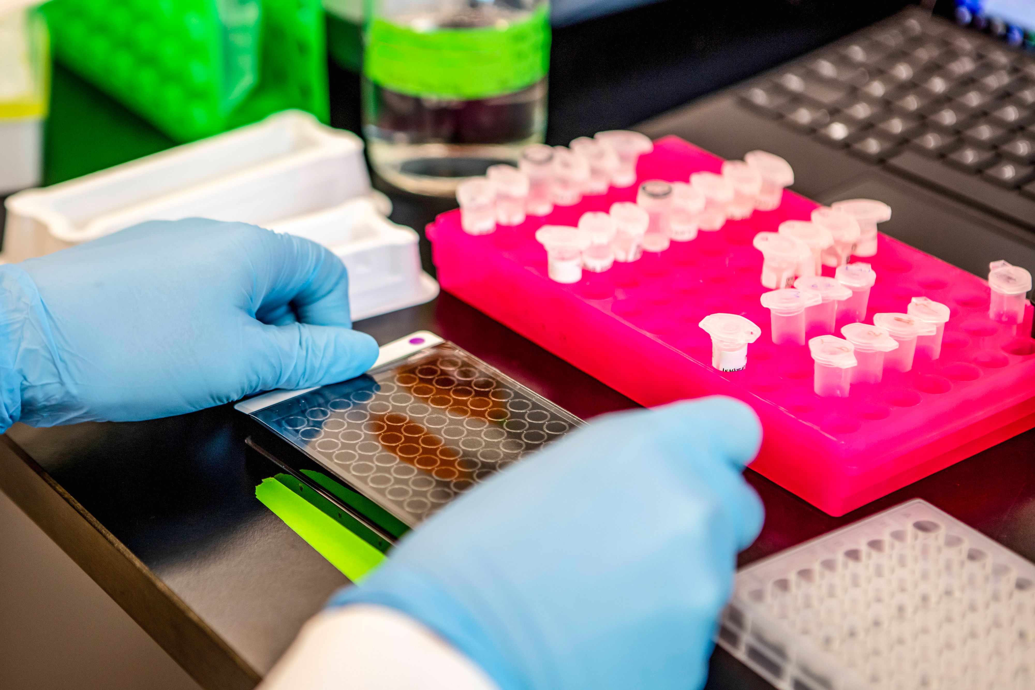 Laut dem deutschen Geheimdienst könnte das Coronavirus in einem Labor entstanden sein.