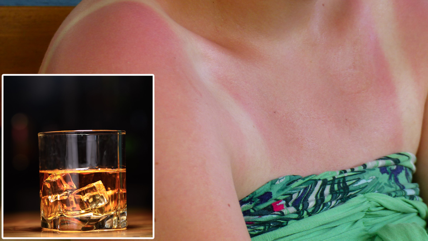 Der Alkohol lenkt vom Sonnenbrandrisiko ab.