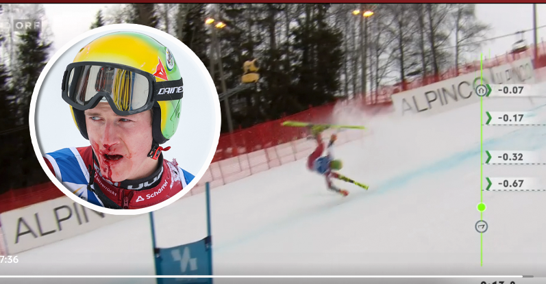 Raphael Haaser flog brutal ab, verlor beim Sturz Zähne.