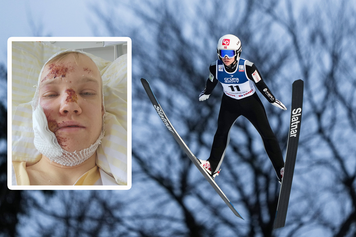 Sondre Ringen muss seine Karriere beenden.